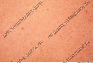 Photo Textures of Human Skin